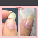 Nail Repair Protection Gel