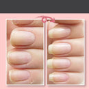 Nail Repair Protection Gel